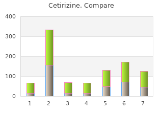purchase cetirizine 10mg without a prescription