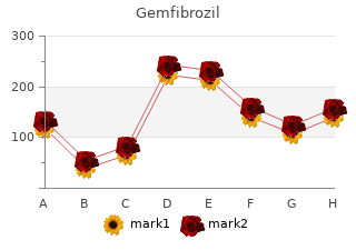 safe 300mg gemfibrozil