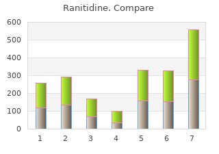 discount ranitidine 150 mg without prescription