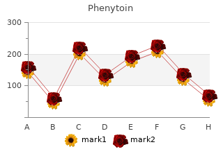 phenytoin 100 mg lowest price